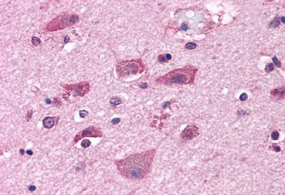 mGluR7 Antibody in Immunohistochemistry (Paraffin) (IHC (P))