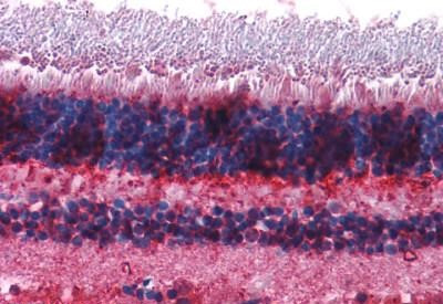 mGluR7 Antibody in Immunohistochemistry (Paraffin) (IHC (P))