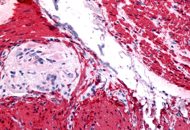 GRPR Antibody in Immunohistochemistry (Paraffin) (IHC (P))