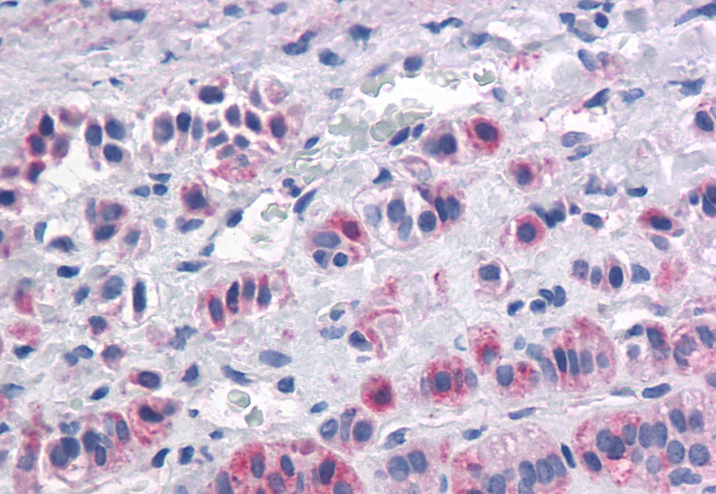 Orexin Receptor 1 Antibody in Immunohistochemistry (Paraffin) (IHC (P))