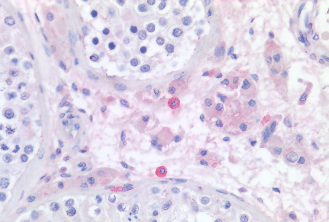 HRH4 Antibody in Immunohistochemistry (Paraffin) (IHC (P))