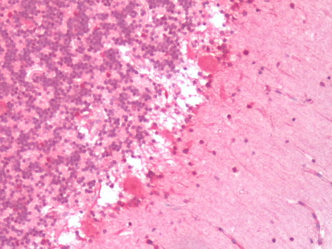 HTR6 Antibody in Immunohistochemistry (Paraffin) (IHC (P))