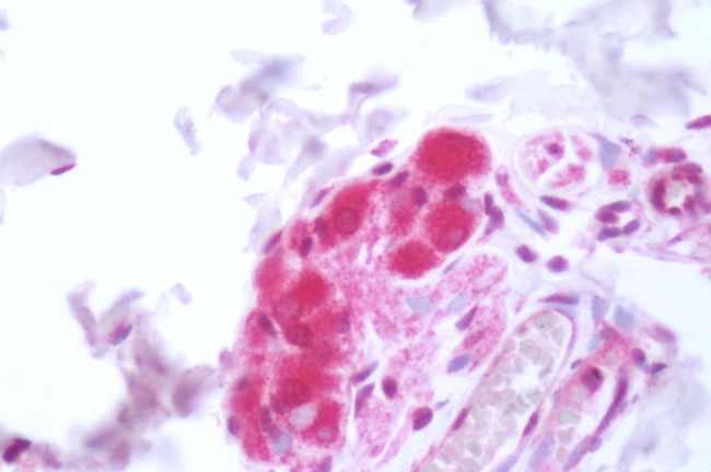 HTR6 Antibody in Immunohistochemistry (Paraffin) (IHC (P))