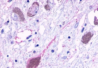 HTR6 Antibody in Immunohistochemistry (Paraffin) (IHC (P))