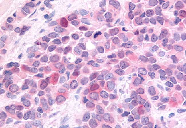 HUNK Antibody in Immunohistochemistry (Paraffin) (IHC (P))