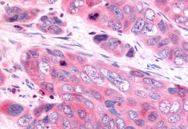 HUNK Antibody in Immunohistochemistry (Paraffin) (IHC (P))