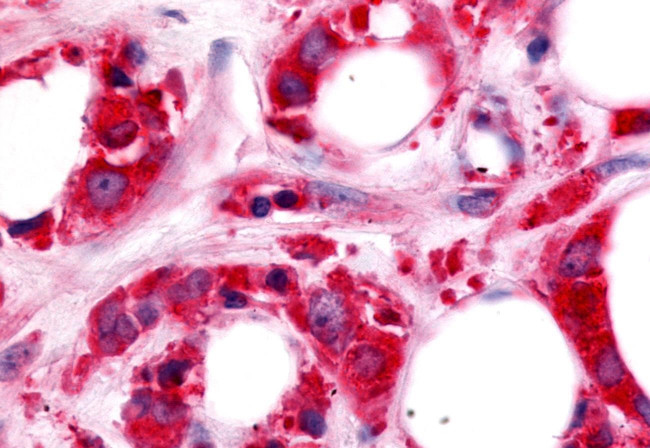 HUNK Antibody in Immunohistochemistry (Paraffin) (IHC (P))