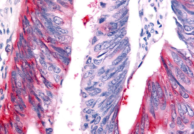 HUNK Antibody in Immunohistochemistry (Paraffin) (IHC (P))