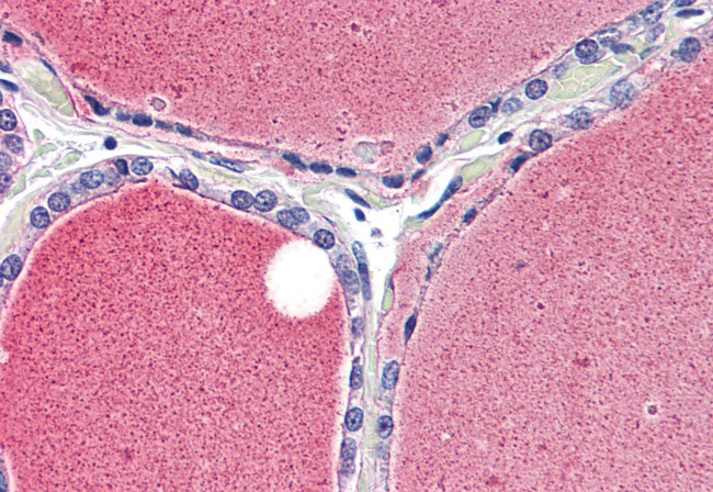 KV1.3 (KCNA3) Antibody in Immunohistochemistry (Paraffin) (IHC (P))