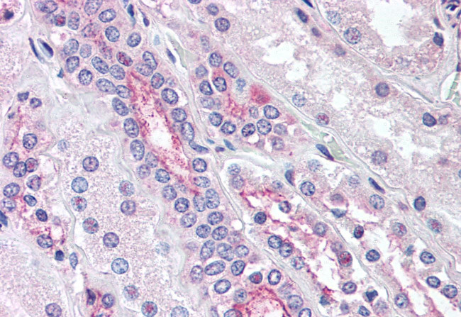 KCNE3 Antibody in Immunohistochemistry (Paraffin) (IHC (P))