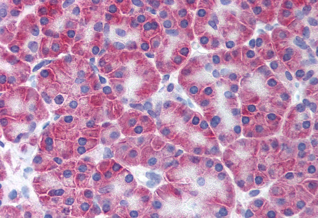 KCNN4 Antibody in Immunohistochemistry (Paraffin) (IHC (P))