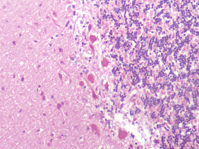 KISS1R Antibody in Immunohistochemistry (Paraffin) (IHC (P))