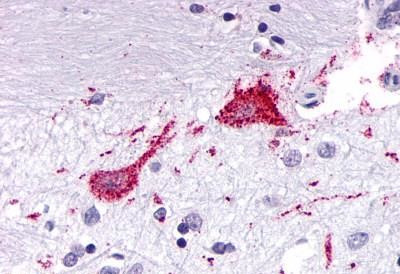 KISS1R Antibody in Immunohistochemistry (Paraffin) (IHC (P))