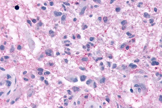 KISS1R Antibody in Immunohistochemistry (Paraffin) (IHC (P))