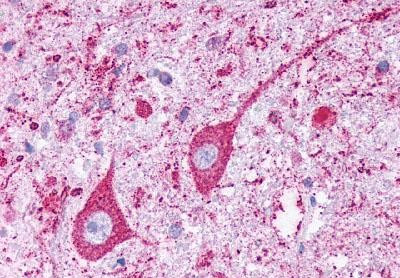 KISS1R Antibody in Immunohistochemistry (Paraffin) (IHC (P))