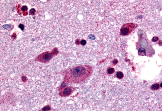 LGR4 Antibody in Immunohistochemistry (Paraffin) (IHC (P))