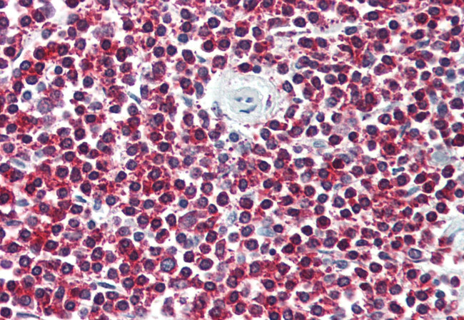 LGR6 Antibody in Immunohistochemistry (Paraffin) (IHC (P))