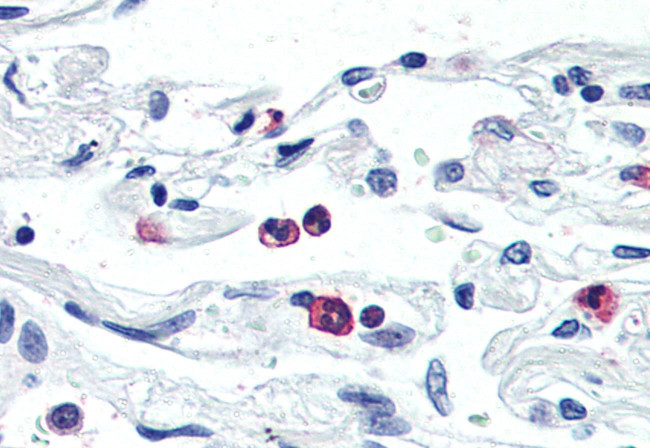 LGR6 Antibody in Immunohistochemistry (Paraffin) (IHC (P))