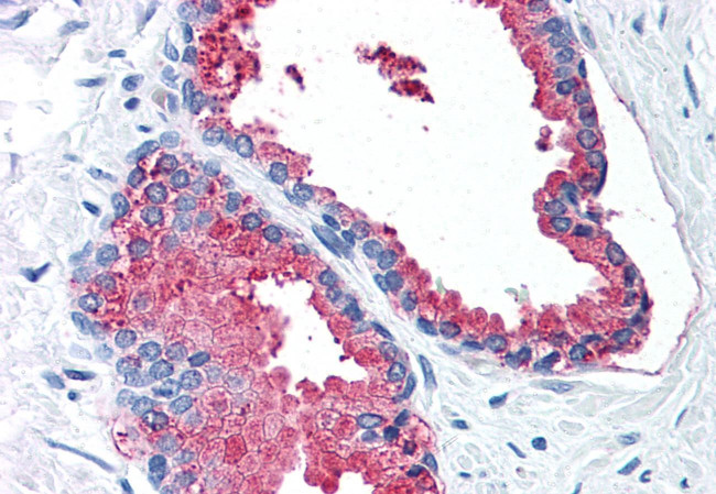 LOXL2 Antibody in Immunohistochemistry (Paraffin) (IHC (P))