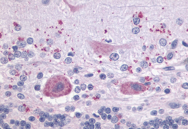 LPAR4 Antibody in Immunohistochemistry (Paraffin) (IHC (P))