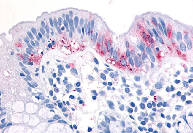 TPL2 Antibody in Immunohistochemistry (Paraffin) (IHC (P))