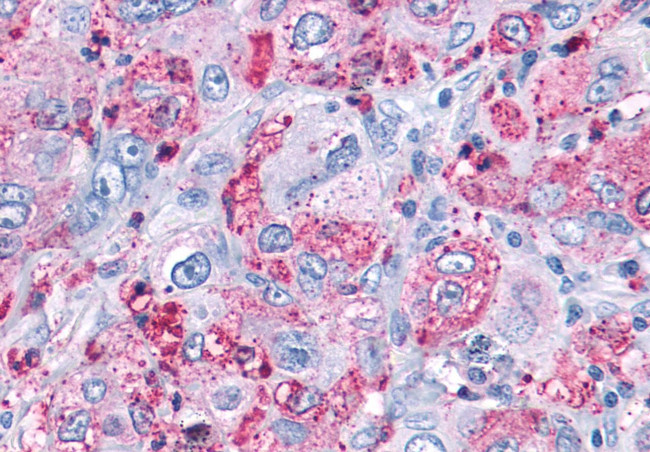 MAS1 Antibody in Immunohistochemistry (Paraffin) (IHC (P))