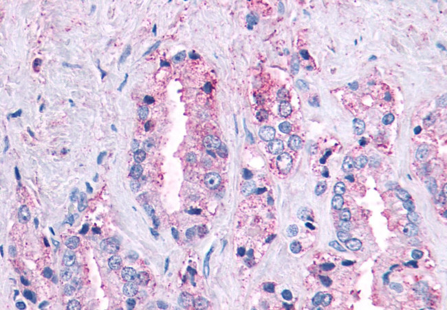 MAS1 Antibody in Immunohistochemistry (Paraffin) (IHC (P))