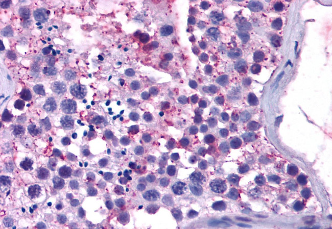 MAS1 Antibody in Immunohistochemistry (Paraffin) (IHC (P))