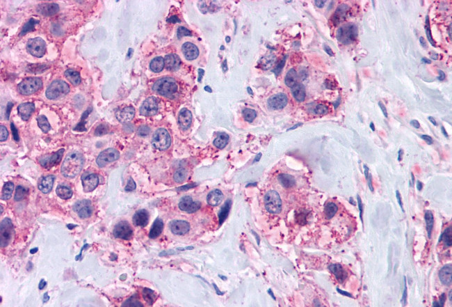 MAS1 Antibody in Immunohistochemistry (Paraffin) (IHC (P))