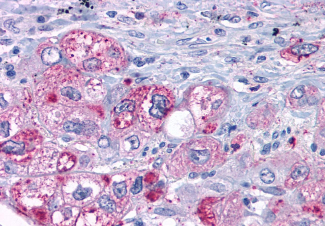 MAS1 Antibody in Immunohistochemistry (Paraffin) (IHC (P))