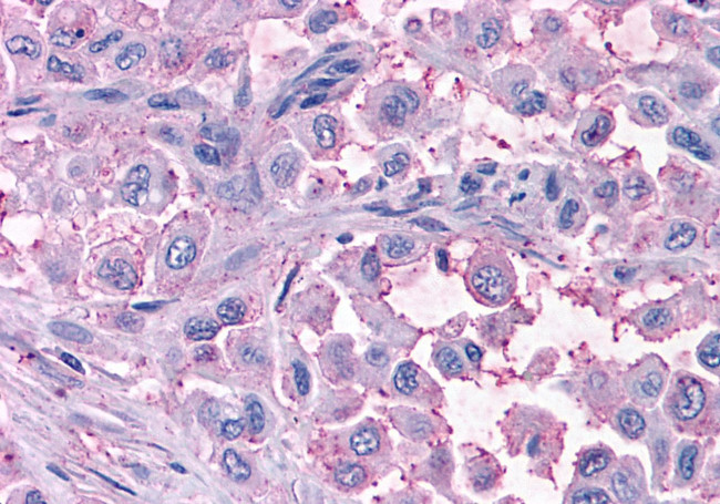 MAS1 Antibody in Immunohistochemistry (Paraffin) (IHC (P))