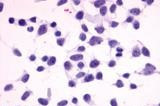 MC4R Antibody in Immunocytochemistry (ICC/IF)