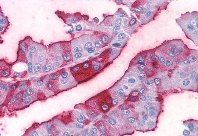 MC4R Antibody in Immunohistochemistry (Paraffin) (IHC (P))