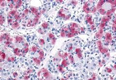 MCHR1 Antibody in Immunohistochemistry (Paraffin) (IHC (P))