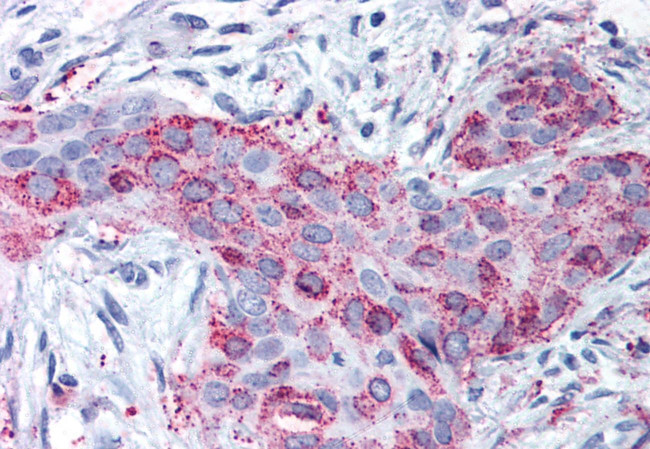 MMP13 Antibody in Immunohistochemistry (Paraffin) (IHC (P))