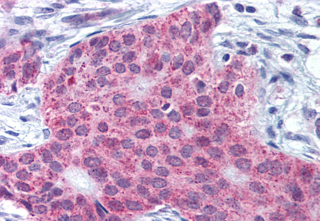 MMP13 Antibody in Immunohistochemistry (Paraffin) (IHC (P))