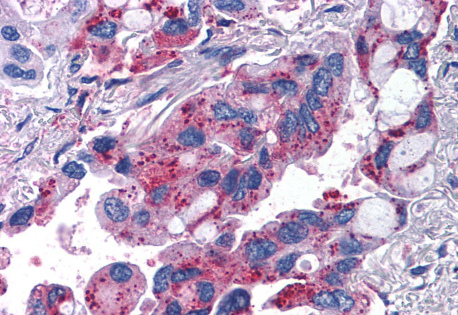 MRGPRX2 Antibody in Immunohistochemistry (Paraffin) (IHC (P))