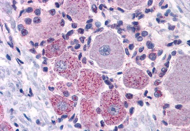 MRGPRX2 Antibody in Immunohistochemistry (Paraffin) (IHC (P))