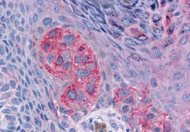 MRGPRX2 Antibody in Immunohistochemistry (Paraffin) (IHC (P))