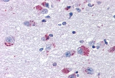 MRGPRX2 Antibody in Immunohistochemistry (Paraffin) (IHC (P))