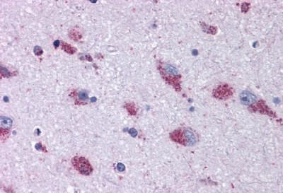 MRGPRX2 Antibody in Immunohistochemistry (Paraffin) (IHC (P))