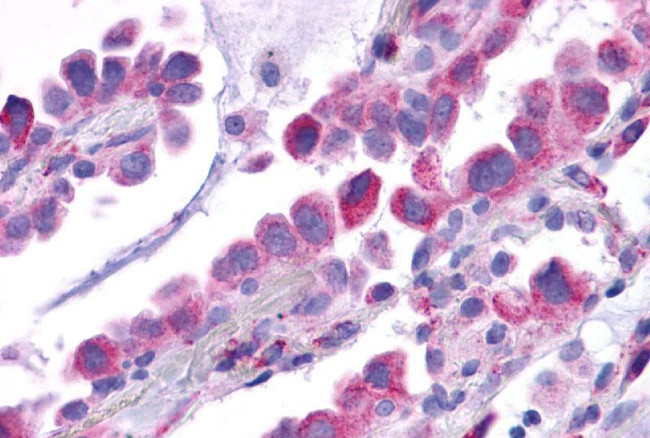 TACR1 Antibody in Immunohistochemistry (Paraffin) (IHC (P))