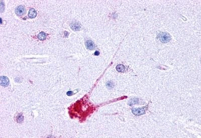 TACR1 Antibody in Immunohistochemistry (Paraffin) (IHC (P))