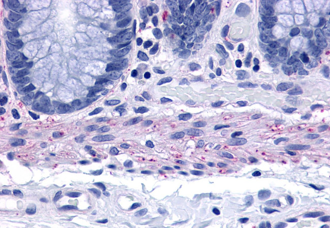 TACR2 Antibody in Immunohistochemistry (Paraffin) (IHC (P))