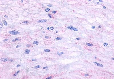 TACR2 Antibody in Immunohistochemistry (Paraffin) (IHC (P))