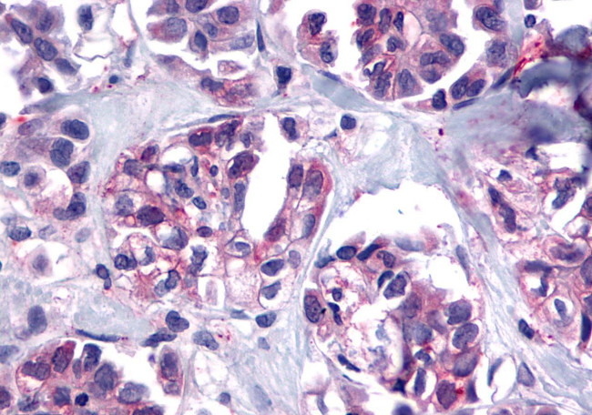 TACR2 Antibody in Immunohistochemistry (Paraffin) (IHC (P))