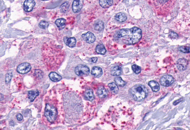 TACR2 Antibody in Immunohistochemistry (Paraffin) (IHC (P))