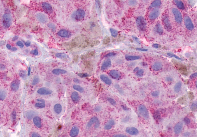 TACR2 Antibody in Immunohistochemistry (Paraffin) (IHC (P))