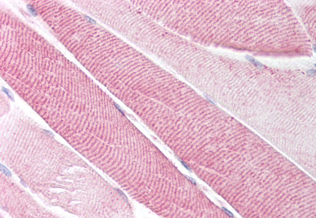 TACR2 Antibody in Immunohistochemistry (Paraffin) (IHC (P))