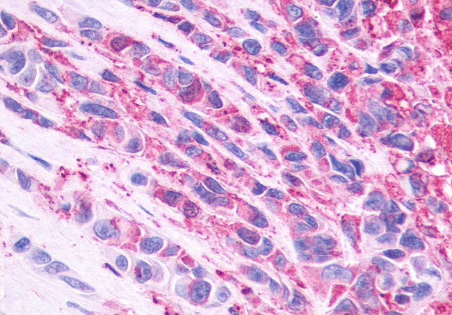 NMBR Antibody in Immunohistochemistry (Paraffin) (IHC (P))